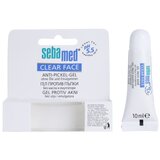 Sebamed Clear Face Anti-Pimple Gel njega problematične kože 10 ml za žene | shoptok.hr