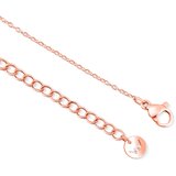 Vuch Elorina Rose Gold Bracelet | ePonuda.com