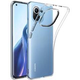  SILIKON MI 11 PROVIDNA XIAOMI PLATOON | Eponuda.ba