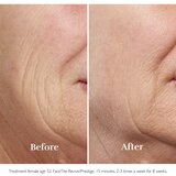 Silkn FaceTite Ritual uređaj za čišćenje lica protiv bora | shoptok.hr