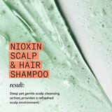 Nioxin System 4 Scalp + Hair Shampoo nježni šampon za obojenu i oštećenu kosu 1000 ml | shoptok.hr