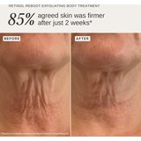 Alpha-H Retinol Reboot nega za telo za učvrstitev kože 120 ml | Shoptok.si