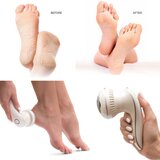 Rio 60 Second Spa Pedi 3 odstranjevalec žuljev | Shoptok.si