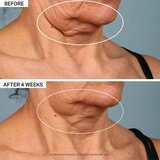 StriVectin Tighten & Lift TL Advanced Tightening Neck Cream Plus krema za vrat i dekolte za sve vrste kože 30 ml Cijene