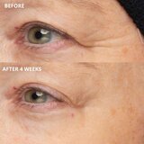 Perricone MD Cold Plasma Plus+ The Intensive Hydrating Complex intenzivna hidratantna krema 30 ml | shoptok.hr