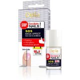 Delia SOS MEGA EFFECT Base Coat učvršćivač & oporavak 11ml Cijene