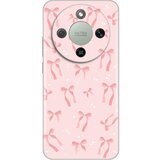  Maska za Honor Magic 8 Lite Bow Silikonska Print – zaštitna, fleksibilna, protivklizna | Eponuda.com