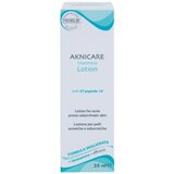 Synchroline Aknicare lokalna nega proti aknam pri seboroičnem dermatitisu 25 ml | Shoptok.si