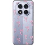  Torbica Silikonska Print Skin za Xiaomi Redmi Note 14 Pro 5G (EU) Cute Bow | ePonuda.com