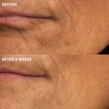 Perricone MD Cold Plasma Plus+ The Intensive Hydrating Complex intenzivna hidratantna krema 30 ml | shoptok.hr
