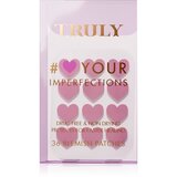 Truly Your Imperfections flasteri za problematičnu kožu lica 36 kom | shoptok.hr