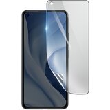3mk Hidrogelna zaš?ita zaslona pred udarci za Xiaomi Mi 11 Lite, Prozorno, (21153809) | Shoptok.si