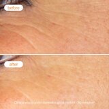 Novexpert Booster serum sa vitaminom C | Eponuda.ba
