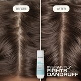 Goldwell Dualsenses Scalp Specialist Anti-Dandruff Shampoo šampon protiv peruti 250 ml | shoptok.hr