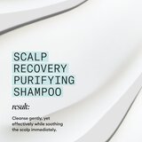 Nioxin Scalp Recovery Purifying Shampoo šampon za rijetku kosu bez volumena protiv peruti 1000 ml | shoptok.hr