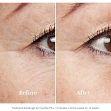Silkn FaceTite Mini uređaj za zaglađivanje i smanjenje bora oko očiju i usana + gel 1 kom | shoptok.hr