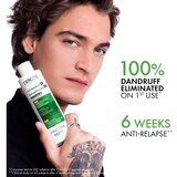 Vichy Dercos Anti-Dandruff šampon i regenerator 2 u 1 protiv peruti 200 ml | shoptok.hr