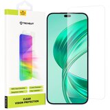 Techsuit Clear Vision Glass kaljeno steklo za Honor X8b/X8c/400 Lite - Transparent | Shoptok.si