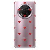  Futrola ultra tanki print clear za honor x9c/magic 7 lite sp013 ( F124812 ) | Eponuda.com