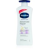 Vaseline Intensive Care regeneracijski losjon za telo z dozirno črpalko 600 ml | Shoptok.si