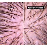 L´Oréal Paris Professionnel Serie Expert Scalp Advanced Anti-Discomfort Lipid Shield Pred-tretman 200ml | shoptok.hr