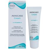 Synchroline Aknicare krema proti aknam pri seboroičnem dermatitisu 50 ml | Shoptok.si