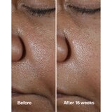 Clinique Smart Clinical™ Repair Wrinke Correcting Serum serum za obraz za korekcijo gub 100 ml | Shoptok.si