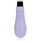 innoGIO GIOperfect GIO-731 ultrazvočna naprava za čiščenje obraza 1 kos | Shoptok.si