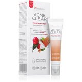 Himalaya Herbals Acne Clear+ Treatment Pen lokalna njega protiv akni 15 ml | shoptok.hr