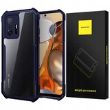 Spacecase OVITEK OVITEK ZA TELEFON XIAOMI 11T 11T PRO MODER, (21964269) | Shoptok.si