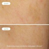Novexpert Ciljani korektor tamnih mrlja – Prirodno Rešenje Protiv Hiperpigmentacije | Eponuda.com