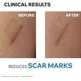 Uriage Bariederm Cica+ Repairing Cream krema za oporavak s bakrom i cinkom 100 ml | shoptok.hr