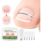 INF Set obližev za korekcijo vraščenih nohtov - 10 obližev 12 mm, (22151622) | Shoptok.si
