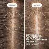 Goldwell Dualsenses Scalp Specialist Clarifying Shampoo šampon za dubinsko čišćenje 250 ml | shoptok.hr