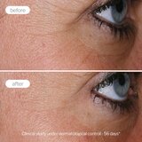 Novexpert Expert Anti-Aging krema – intenzivna nega protiv bora za suvu kožu | Eponuda.com