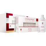 CADU-CREX Hair Loss HSSC Advanced Hair Loss kura za kosu za žene protiv uznapredovalog opadanja kose ekonomično pakiranje | shoptok.hr