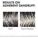 Vichy dercos anti-dandruff advanced action šampon proti prhljaju 200 ml za ženske | Shoptok.si