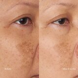 Perricone MD Hypoallergenic Clean Correction hidratantna i hranjiva krema 59 ml | shoptok.hr