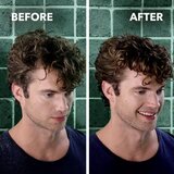 Schwarzkopf Schauma Anti-Dandruff umirujući šampon protiv peruti 400 ml | shoptok.hr