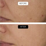 Cocunat Clinical Beauty Filler set proti staranju kože | Shoptok.si
