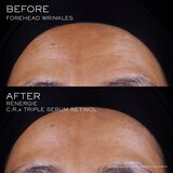 Lancôme Rénergie CRX Triple Serum Retinol serum za obraz 50 ml | Shoptok.si