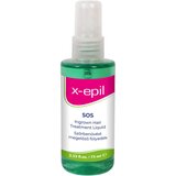 X EPIL SOS - tekućina protiv rasta dlačica (75ml) | shoptok.hr
