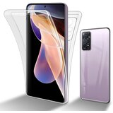 Cadorabo Xiaomi v prozorni - 360 -° ° zaščitni pokrov celotnega telesa - zaščita pred sprednjim in hrbtom, vsestransko zaščito z zaščitnim zaslonom, (20591502) | Shoptok.si