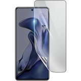 3mk hidrogelna zaš?ita zaslona pred udarci za xiaomi 11T, prozorno, (21154450) | Shoptok.si
