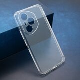  Futrola clear fit za honor 400 pro providna ( F120475 ) | ePonuda.com