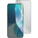 3mk hidrogelna zaš?ita zaslona pred udarci za oneplus 8T, prozorno, (21154264) | Shoptok.si