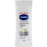 Vaseline intensive care advanced repair vlažilen losjon za telo za suho kožo 400 ml za ženske Cene