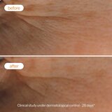 Novexpert Vitamin C Radiance Piling – Za Blistaviji, Glađi i Ujednačeniji Ten | Eponuda.com