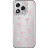  maska za honor 400 lite cute bow silikonska print skin | ePonuda.com