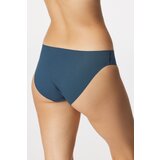 Jadea Klasične hlačke Laser | Shoptok.si
